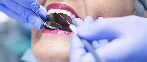 Best Emergency Dentist for Knocked-Out Tooth in Ketchum, ID